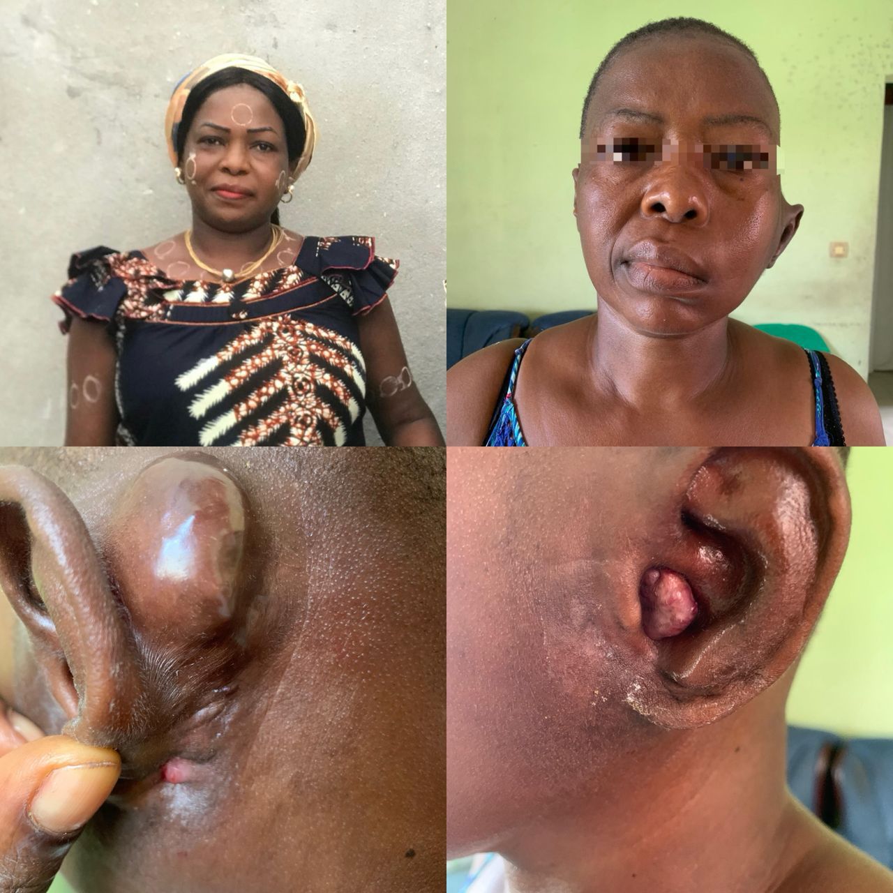 SAUVONS MAMAN KOUASSI AMENAN IRÈNE